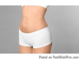 What Body Part Is Most Painful To Liposuction?