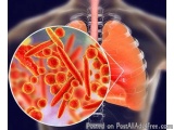 Professional Chest Specialist Doctor in Jaipur, Rajasthan – Dr. Sheetu Singh