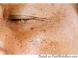 The image is a close-up of a person's face, specifically their eye. The eye appears to be closed, with the pupil slightly ope...
