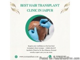 Best Hair Transplant Clinic In Jaipur