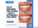 Teeth Whitening Cost In India – Safe & Affordable Treatment