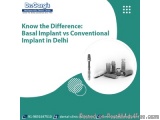 The image is an advertisement for Dr. Garg's Basal Implant vs Conventional Implant in Delhi. It has a white background with a...