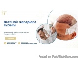 Hair Transplant Cost in Delhi â€“ Complete Price Guide for Safe & Effective Results
