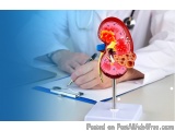 The image shows a model of the human kidney on a stand. The model is red and yellow in color and is placed on a white desk. T...