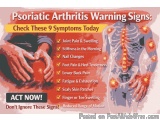 Psoriatic Arthritis Warning Signs: Check These 9 Symptoms Today