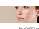 Skin Treatment by Top Homeopathy Doctor in Noida