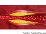 Manage Your High Cholesterol with Homeopathic Medicine