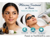 Best Melasma Treatment In Thane At Dna Royal Aesthetic Clinic | A...