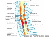 Cervical Spine Surgery  by Dr. B. Leela Prasad