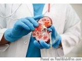 The image shows a person wearing a white lab coat and blue gloves holding a small model of a human heart. The person is holdi...