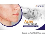 The image is an advertisement for an acne treatment. On the left side of the image, there is a close-up of a woman's face wit...