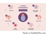 The image is an infographic that explains the process of in vitro fertilization. It is divided into six sections, each repres...