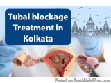 The image shows a medical illustration of a tubal blockage treatment in Kolkata, India. The illustration shows a surgical ins...