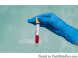 Mumps Blood Test in Delhi