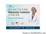 Best Anti-Scar & Skin Rejuvenation Treatments in Delhi NCR by Dr. Richa Kumar!